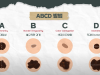 점이 아니라 피부암일 수 있다고?… 피부암 'ABCD 법칙' 꼭 기억하세요