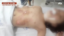 무면허로 초등생 쳐 안면골절 시킨 80대男 